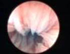 fertiloscopia005