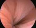 fertiloscopia006