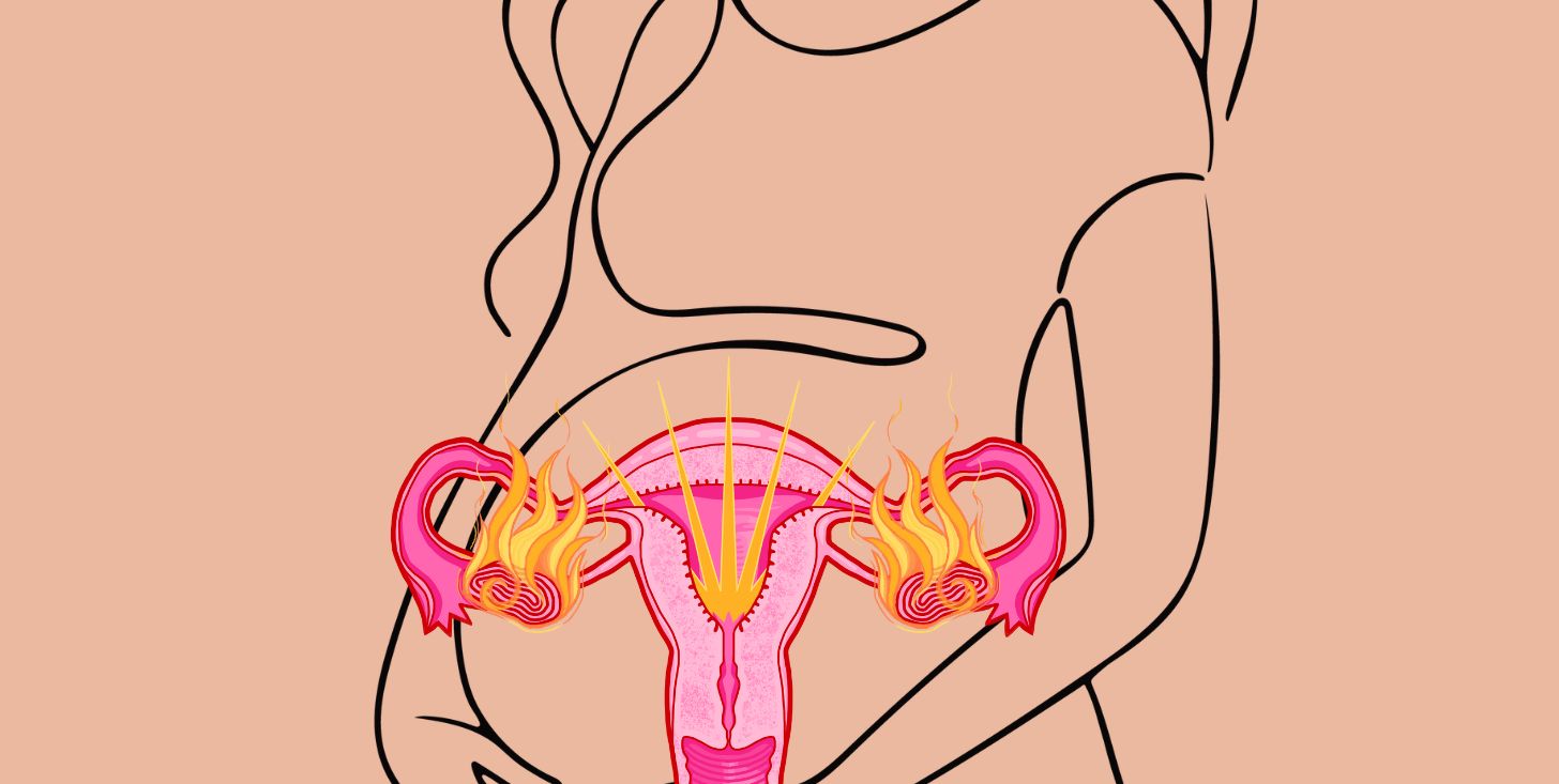 ho l8217endometriosi che possibilit224 ho di rimanere incinta con la pma